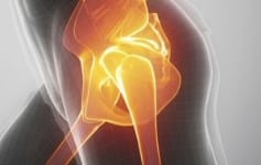 Labral Tear- What is it and its treatment